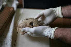 Hitler Skull Bullethole